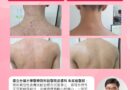 中重度異位性皮膚炎僅花半年破關健保 成功脫胎換骨重生、近乎病灶清零